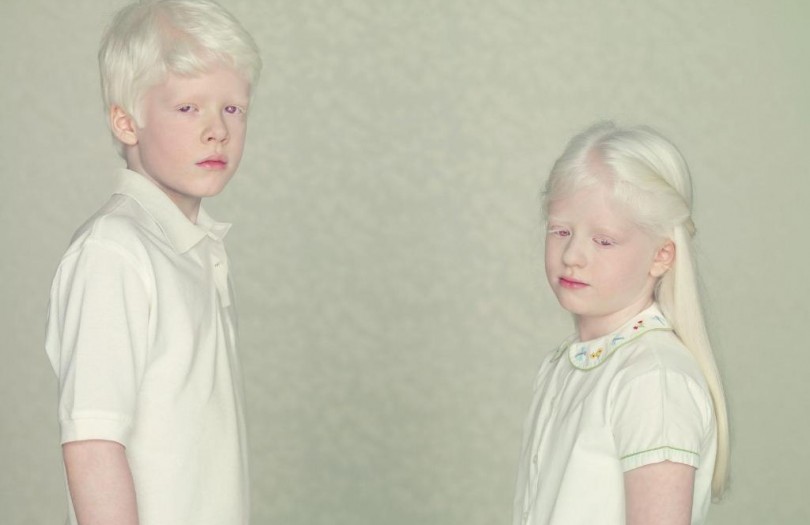 http://fullpicture.ru/wp-content/uploads/2014/08/Ne-takie-kak-vse-lyudi-albinosy-3-810x525.jpg