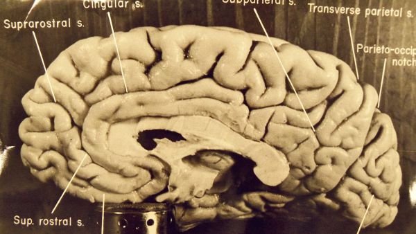 16. Мозок Ейнштейна був витягнутий майже відразу після смерті вченого. 