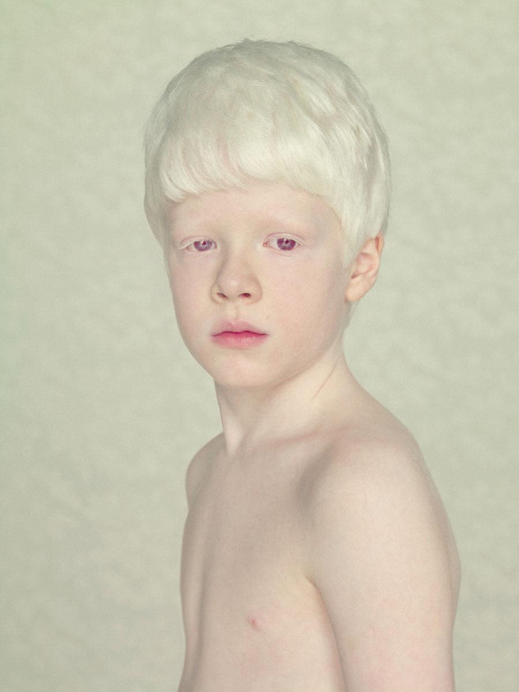Не такие как все люди-альбиносы-2