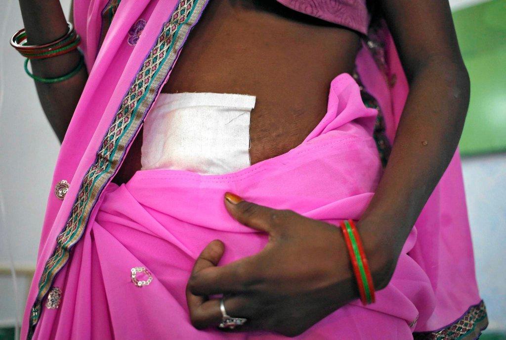 Смертельная стерилизация женщин в Индии-1
