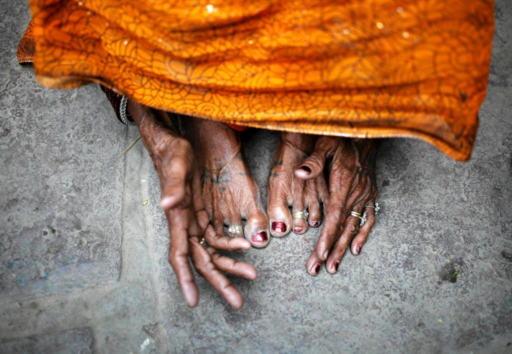 Смертельная стерилизация женщин в Индии-2