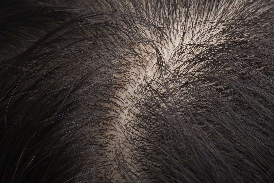 30 интересных фактов о волосах, которые вы не знали-26