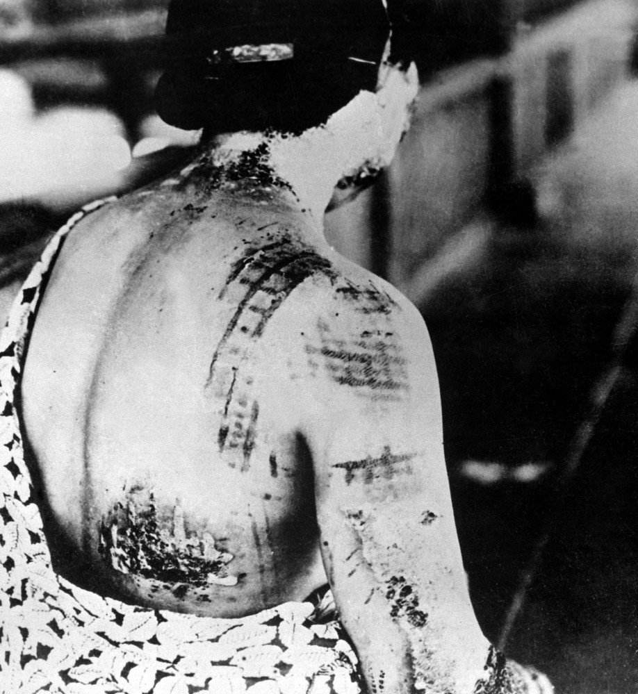 Стёртые с лица земли Хиросима и Нагасаки 70 лет назад -4