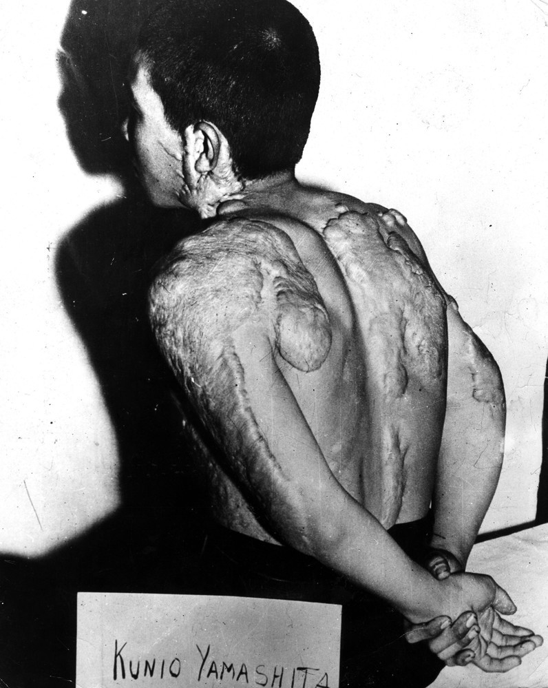 Стёртые с лица земли Хиросима и Нагасаки 70 лет назад -8