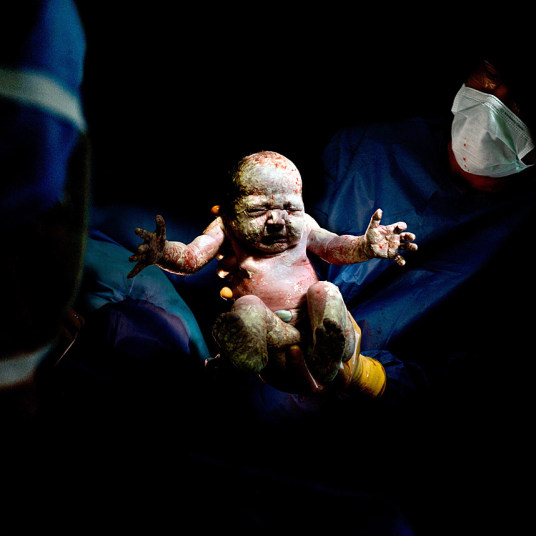 10. Рожденный через кесарево сечение: Фото: Кристиан Бертелот.