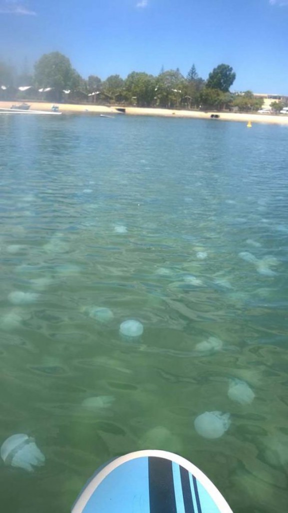 18. А в воде вас поджидают опасные медузы.