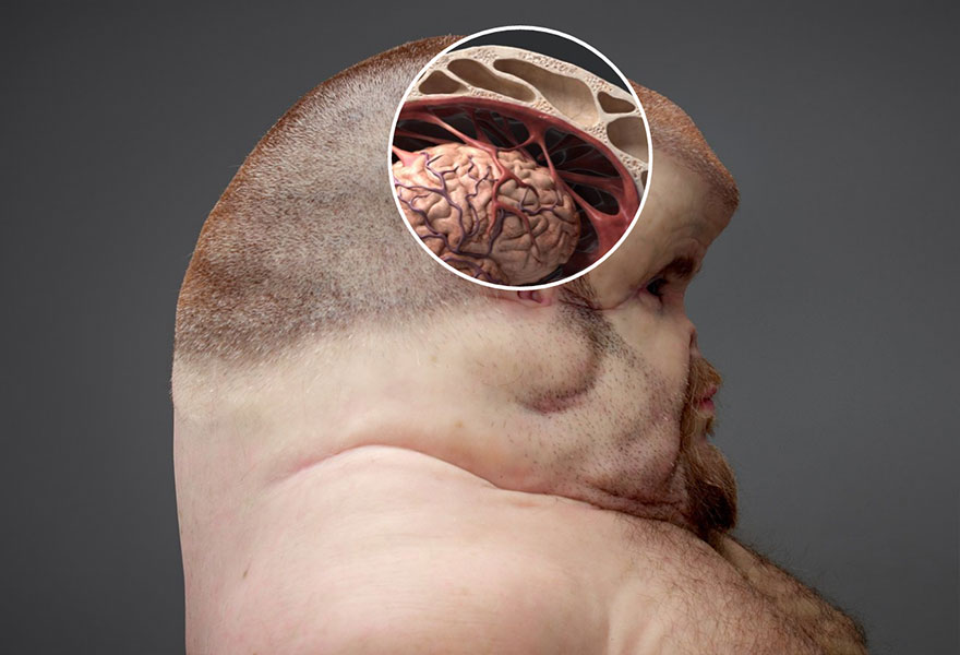 6. Мозг Грэма такой же, как у нас, но его череп больше и имеет большее количество жидкости и связок, чтобы поддерживать мозг при столкновении.