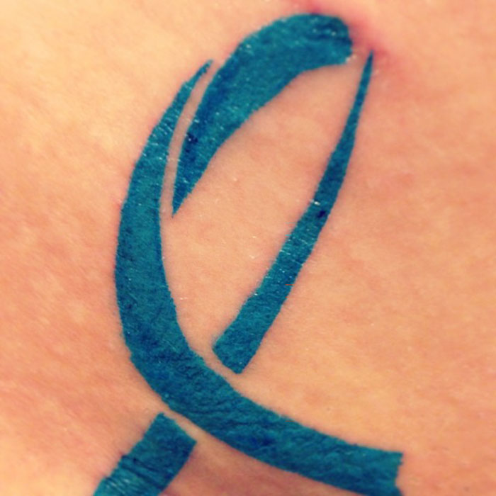 10. Татуировка в виде символа рака яичников на шраме, оставшемся после операции по удалению правого яичника.