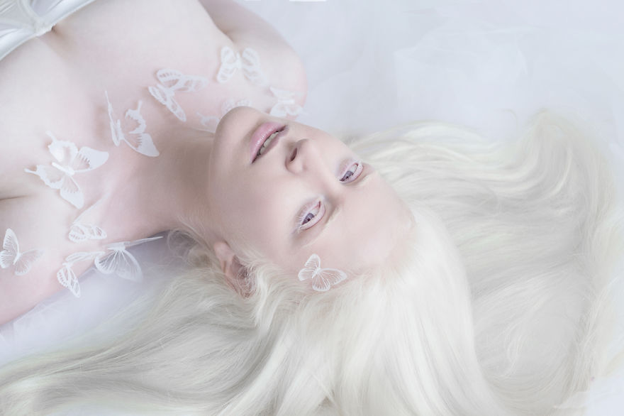 1. Фотограф Юлия Тайц загорелась идеей создания серии фотографий людей с альбинизмом или людей альбиносов.