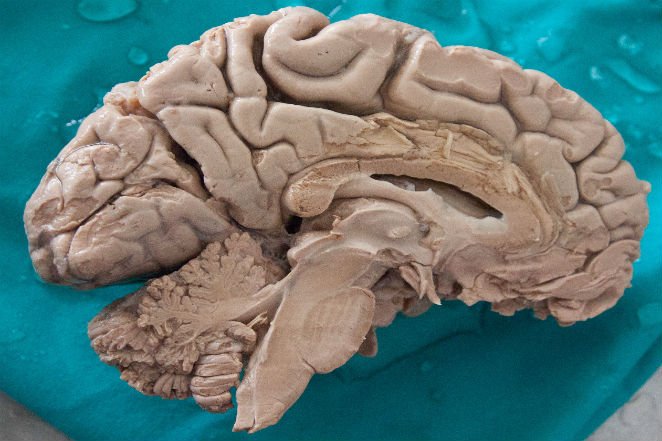 15. Человеческий мозг - единственный мозг, сокращающийся с возрастом.