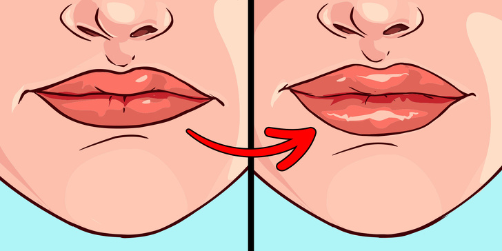 7. Опухшие губы.