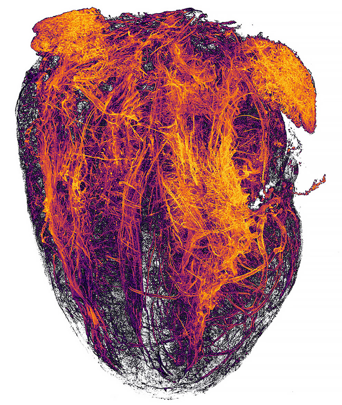 19. Кровеносные сосуды сердца мыши после инфаркта миокарда.