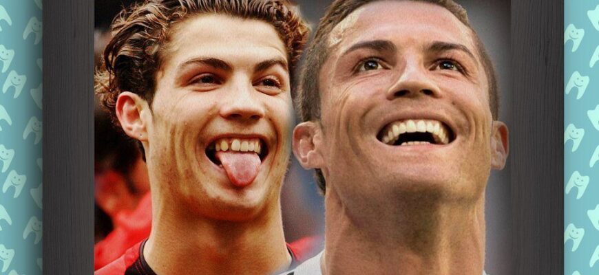 negollivudskie-ulybki-zvyozd-v-nachale-ih-karery-1