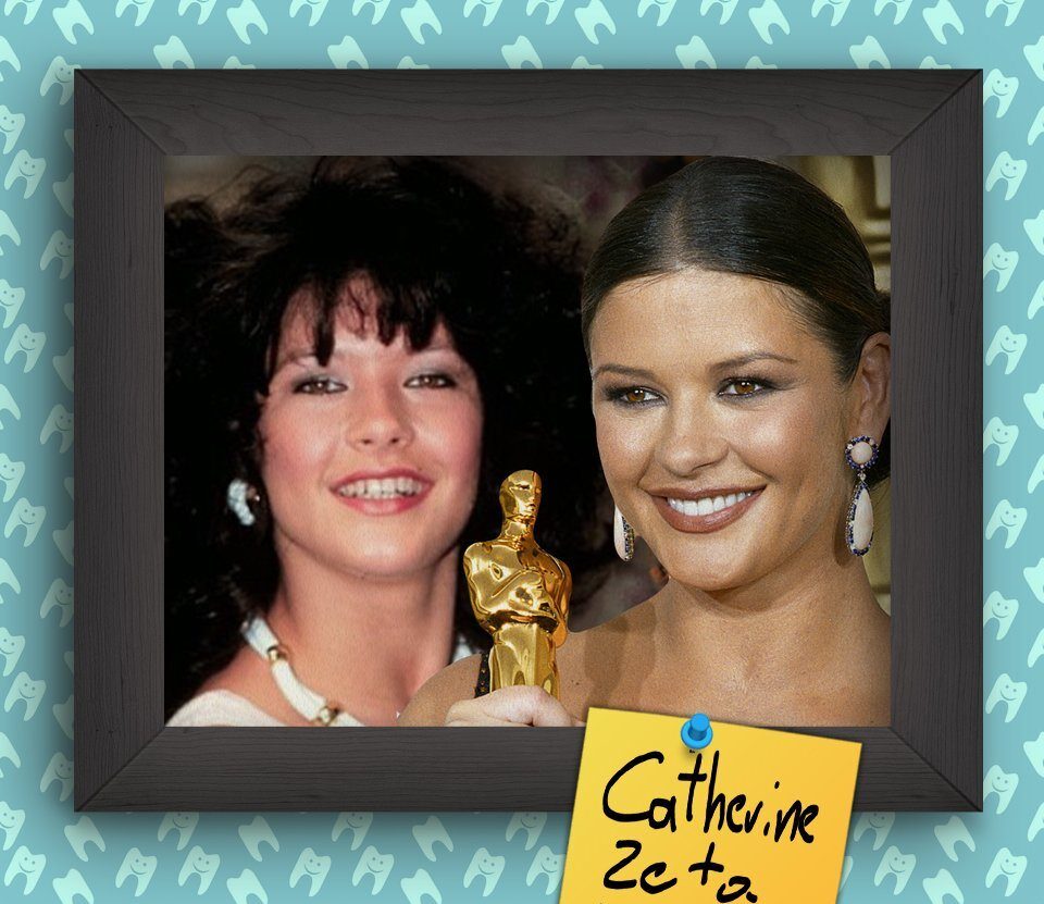 negollivudskie-ulybki-zvyozd-v-nachale-ih-karery-2