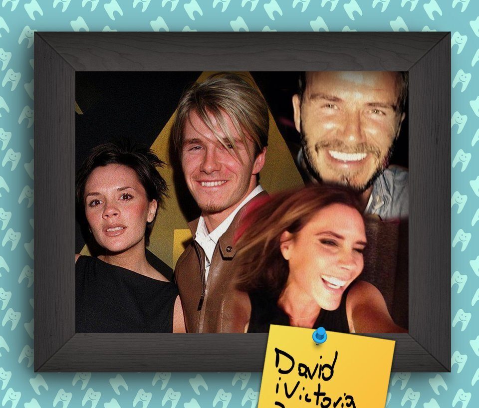 negollivudskie-ulybki-zvyozd-v-nachale-ih-karery-4