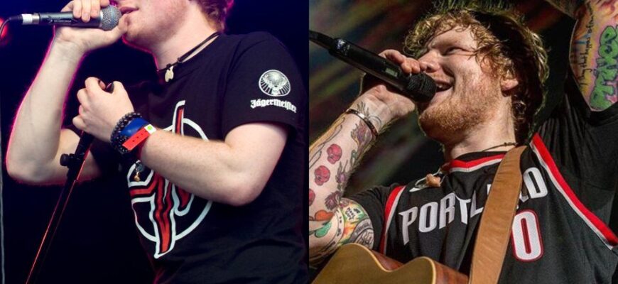 celebrity-tattoos-before-and9