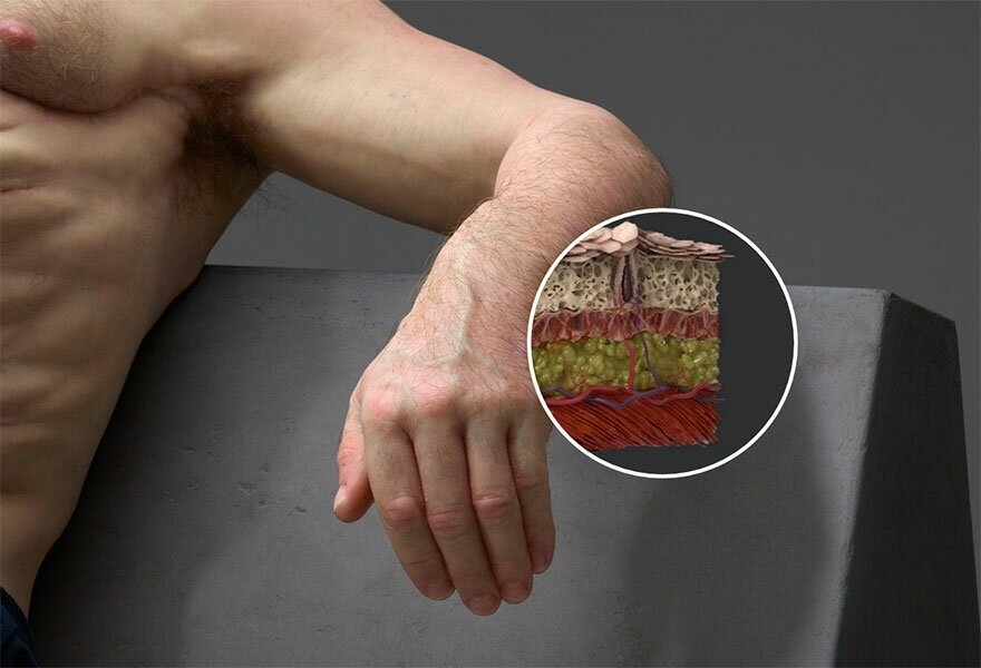 12. Кожа Грэма толще и прочнее нашей. Это уменьшит получение не только ссадин, но и серьезных повреждений кожных покровов.