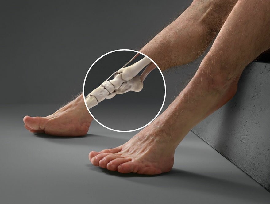 13. Сильные, копытообразные ноги с дополнительными суставами отлично пружинят и защитят пешеходов при столкновении.